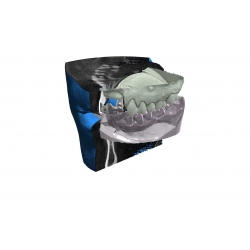 Модул exocad exoplan viewer