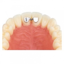 Retainers Sup 6mm 10 Bucati Leone