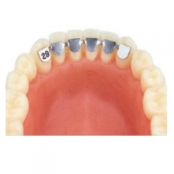 Ретайнер за долен кучешки/кучешки 33mm 2 броя Leone