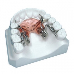 Dispozitiv distalizare stanga Fast Back 9mm Leone