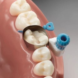 Циркумферентни матрици Dentsply PALODENT 360 1 брой